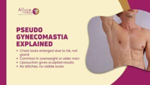 What Is Pseudo Gynecomastia_ Causes, Diagnosis & Treatment