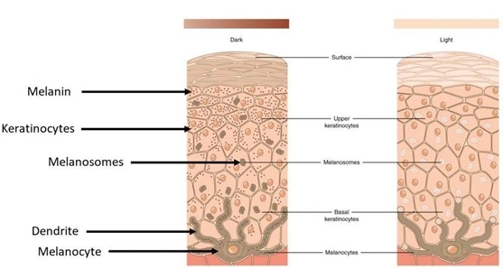 Causes of pigmentation in mumbai, india