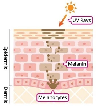 Key Factors Influencing Pigmentation