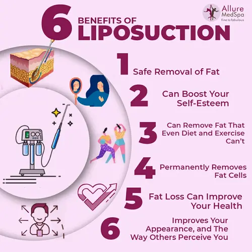 Liposuction Surgery 7 INFOGRAPHIC Liposuction