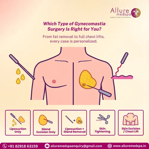 Types of Gynecomastia Surgery