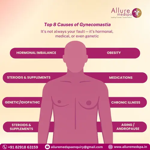 causes of gynecomastia