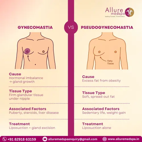 gynecomastia vs pseudogynecomastia