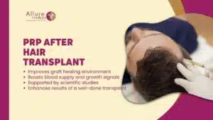 PRP After Hair Transplant in Mumbai, India