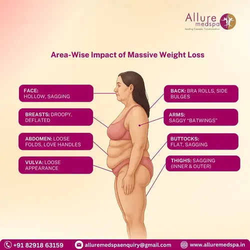Area wise impact of massive weight loss in Mumbai, India