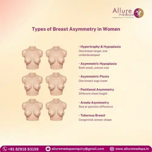Types of Breast Asymmetry in Women in Mumbai, India