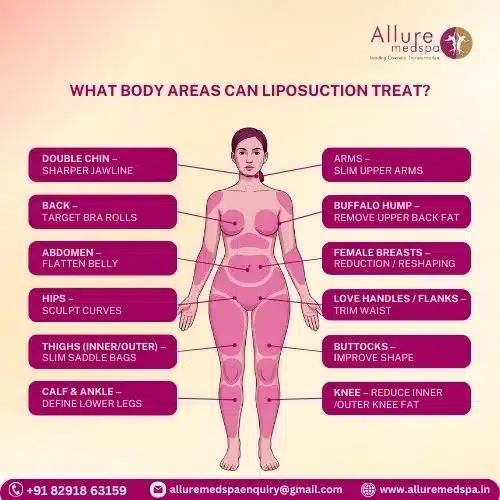 Liposuction Surgery 46 What Body Areas Can Liposuction Treat in Mumbai, India