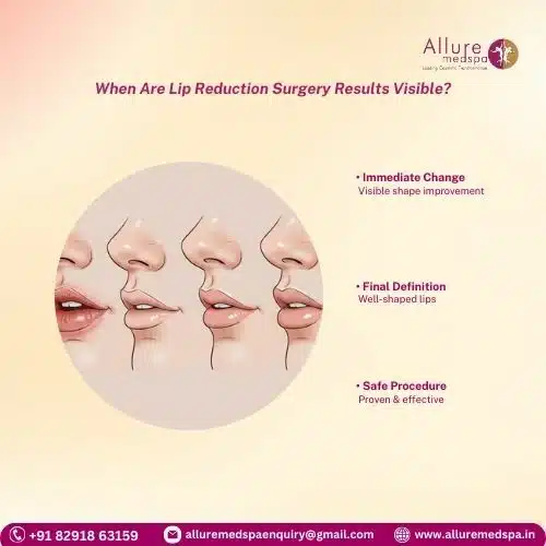 When Are Lip Reduction Surgery Results Visible in mumbai, India