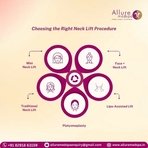 Choosing the Right Neck Lift Procedure