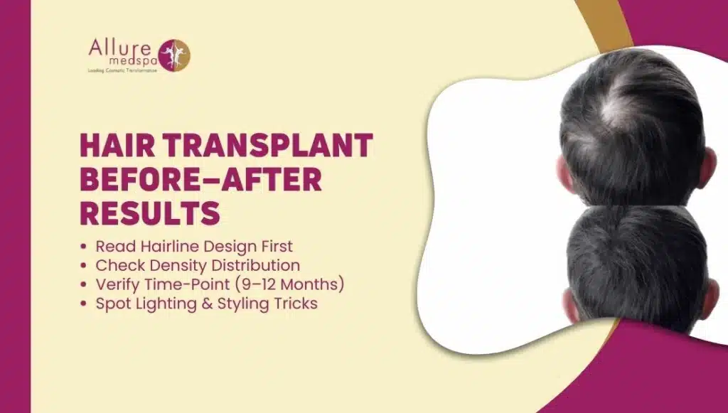 Hair Transplant Before–After: How to Read Results (Realistic Expectations)