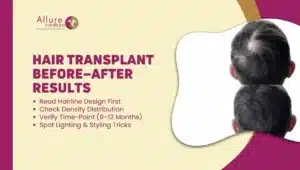 HAIR TRANSPLANT BEFORE–AFTER RESULTS