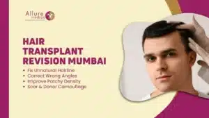 HAIR TRANSPLANT REVISION MUMBAI, India