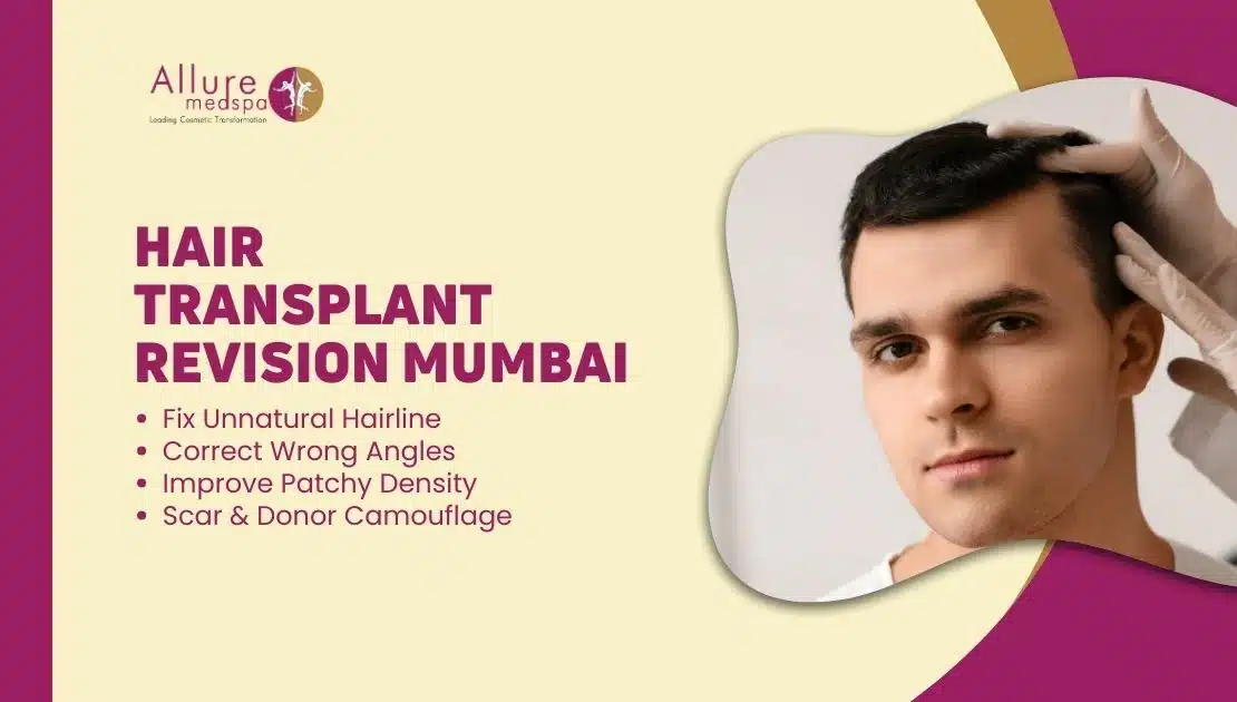 HAIR TRANSPLANT REVISION MUMBAI, India