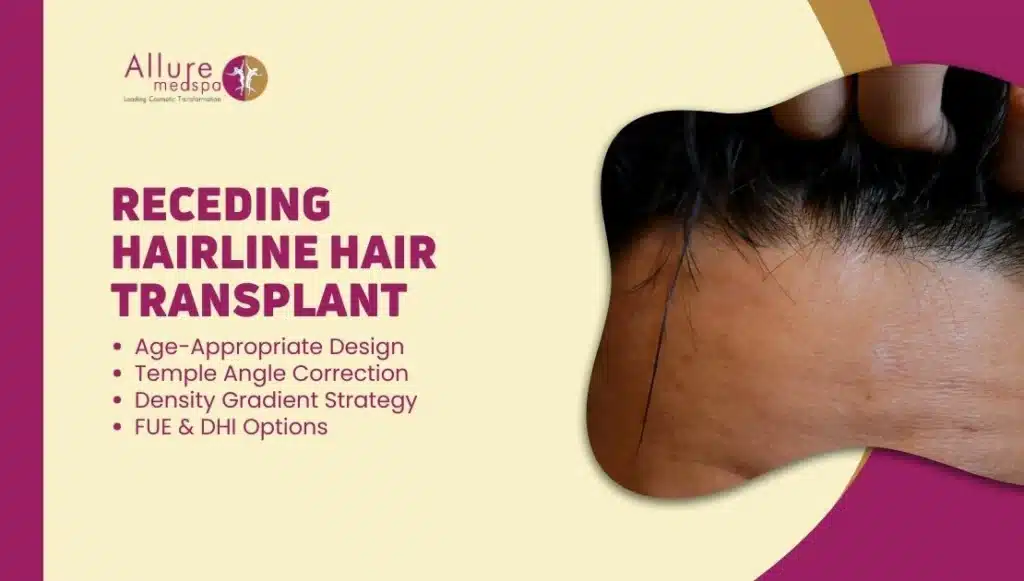 Receding Hairline Hair Transplant in Mumbai: Natural Hairline Restoration (What to Expect)