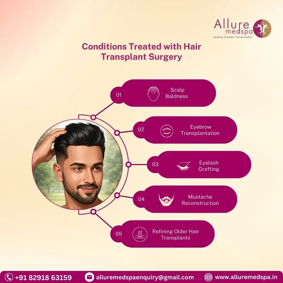 Conditions Treated with Hair Transplant Surgery in Mumbai, india