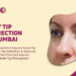 bulbous nasal tip in Mumbai, India