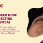 CROOKED NOSE CORRECTION IN MUMBAI, India