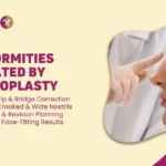 DEFORMITIES TREATED BY RHINOPLASTY in Mumbai