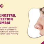 WIDE NOSTRIL CORRECTION IN MUMBAI