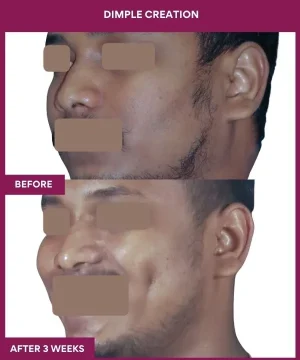 Dimple plasty in Mumbai, india